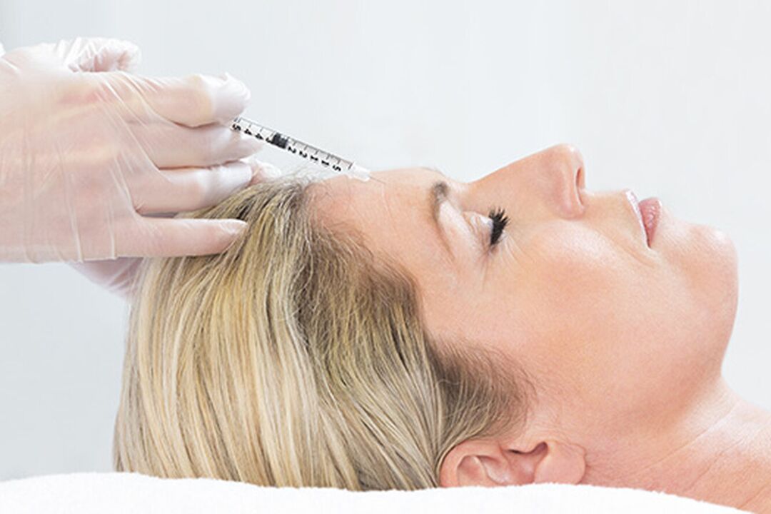 Le plasmolifting est une méthode d'injection pour le rajeunissement de la peau du visage. 